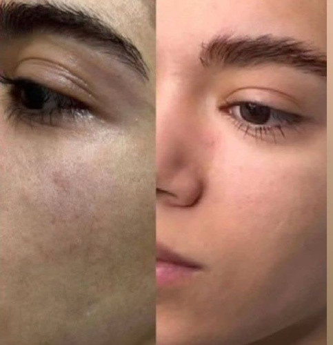 خرید کرم بیوممتیک 5کاره اورجینال جوانساز و با روش بیوممتیک یکبار اصولی و طبیعی به فریاد پوست برس و نجاتش بدهگاتیو ایتالیا- ویتامین سی ۴۰ میل گاتیو - فروشگاه زیبایی با بیتا