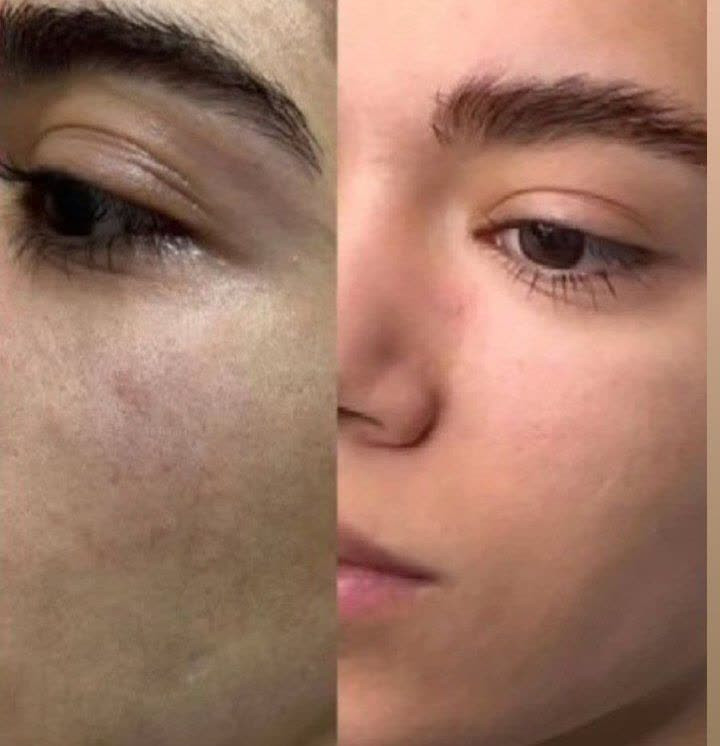 خرید کرم بیوممتیک 5کاره اورجینال جوانساز و با روش بیوممتیک یکبار اصولی و طبیعی به فریاد پوست برس و نجاتش بدهگاتیو ایتالیا- ویتامین سی ۴۰ میل گاتیو - فروشگاه زیبایی با بیتا