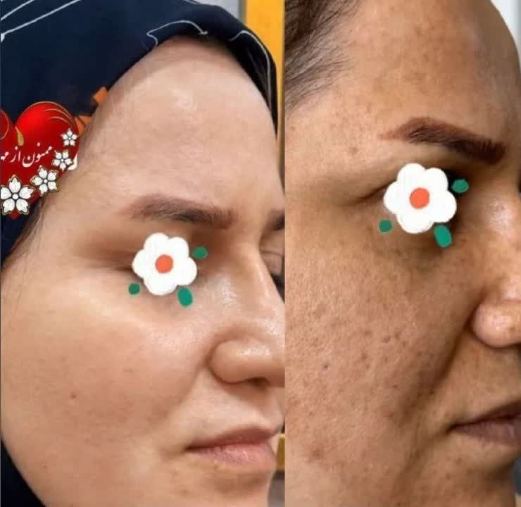 خرید کرم بیوممتیک 5کاره اورجینال جوانساز و با روش بیوممتیک یکبار اصولی و طبیعی به فریاد پوست برس و نجاتش بدهگاتیو ایتالیا- ویتامین سی ۴۰ میل گاتیو - فروشگاه زیبایی با بیتا