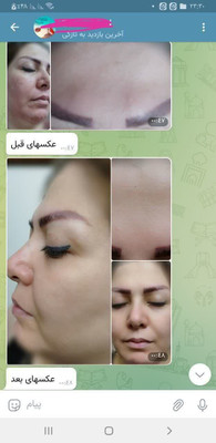 Product 4