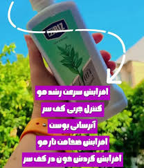 تونیک مو افزایش گردش خون مویرگی در پوست سر ۳۰۰ میل